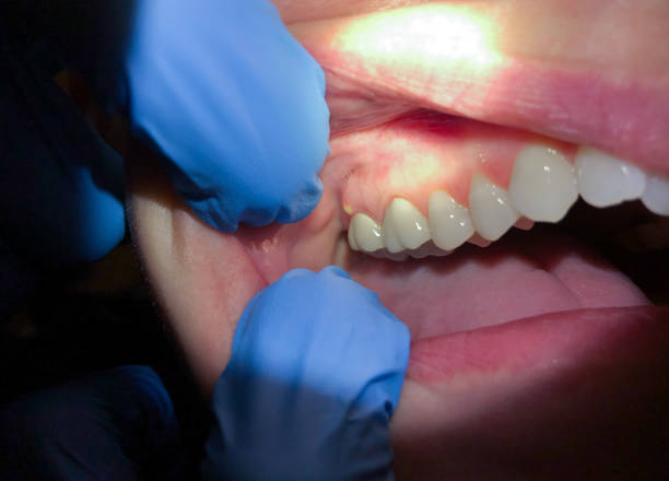 Best Emergency Dentist Near Me  in Cherry Brah, NC